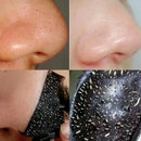 Máscara Facial Removedora de Cravos - Reduz Poros, Controla Acne, 20g